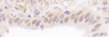 Rabbit Rad6 Antibody