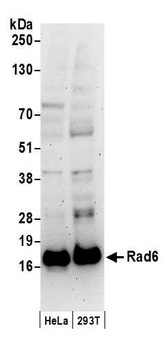 Rabbit Rad6 Antibody