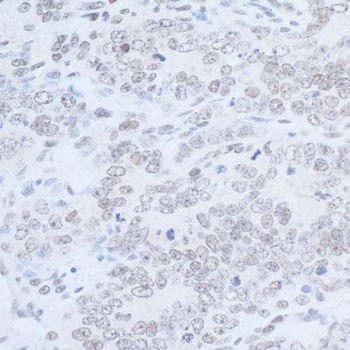 Rabbit Rad6 Antibody