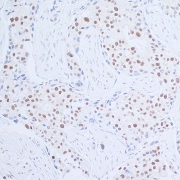 Rabbit Rad6 Antibody