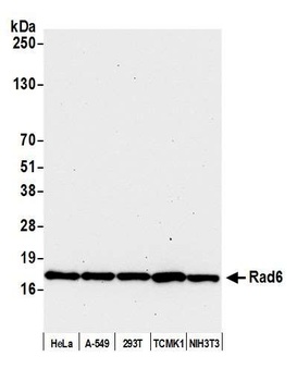 Rabbit Rad6 Antibody