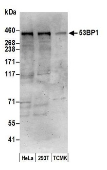 Rabbit 53BP1 Antibody