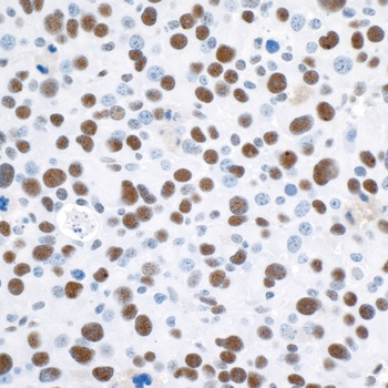 Rabbit 53BP1 Antibody