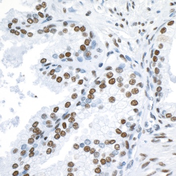 Rabbit 53BP1 Antibody