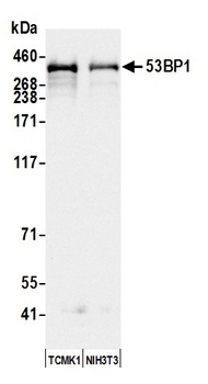 Rabbit 53BP1 Antibody