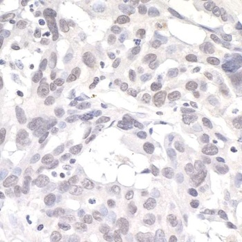 Rabbit PNK1 Antibody