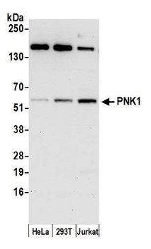 Rabbit PNK1 Antibody