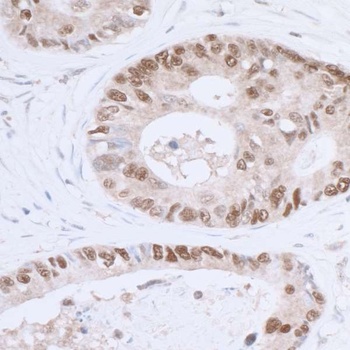 Rabbit p53 Antibody