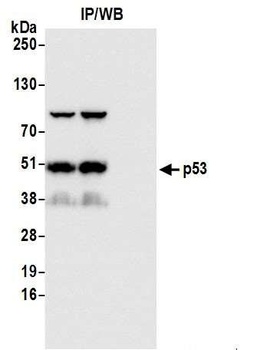 Rabbit p53 Antibody