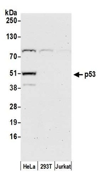 Rabbit p53 Antibody