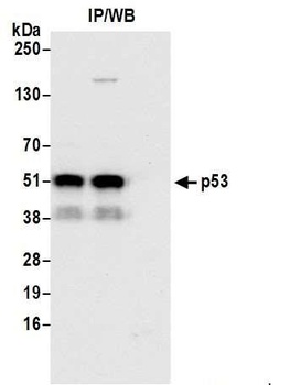 Rabbit p53 Antibody