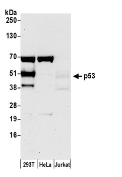 Rabbit p53 Antibody