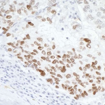Rabbit p53 Antibody