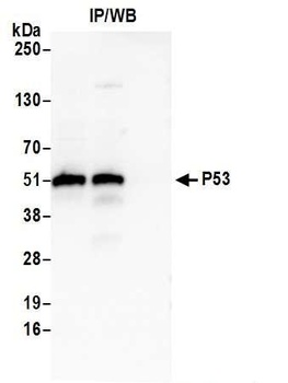 Rabbit p53 Antibody