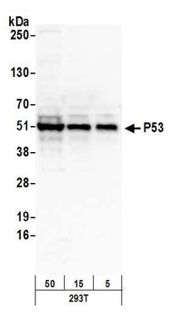 Rabbit p53 Antibody