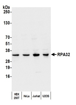 Rabbit anti-RPA32 Antibody