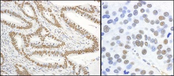 Rabbit Phospho XRCC1 (S485/T488) Antibody