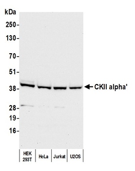 Rabbit CKII alpha' Antibody