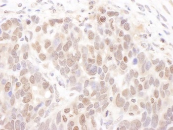 Rabbit CKII alpha Antibody