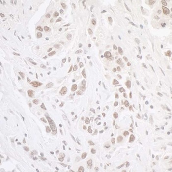 Rabbit CKII alpha Antibody