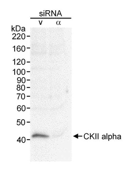 Rabbit CKII alpha Antibody