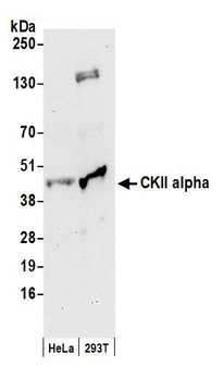 Rabbit CKII alpha Antibody