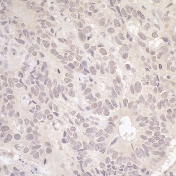 Rabbit RFC3 Antibody