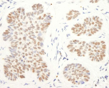 Rabbit CoREST Antibody