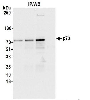 Rabbit p73 Antibody