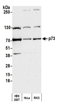 Rabbit p73 Antibody