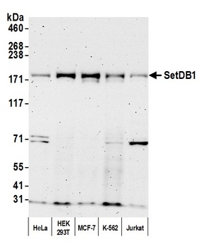 Rabbit anti-SETDB1 Antibody