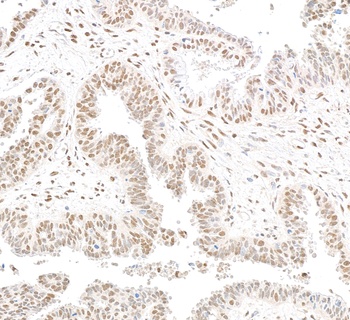 Rabbit RbBP5 Antibody
