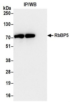 Rabbit RbBP5 Antibody