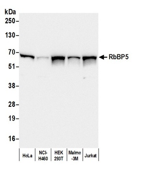 Rabbit RbBP5 Antibody