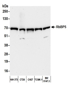 Rabbit RbBP5 Antibody