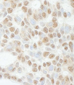 Rabbit ADNP Antibody