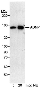 Rabbit ADNP Antibody