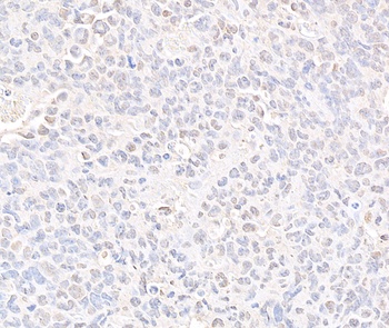 Rabbit SMC3 Antibody