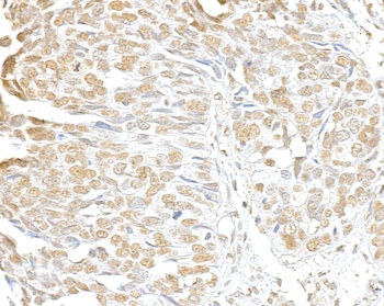 Rabbit SMC3 Antibody