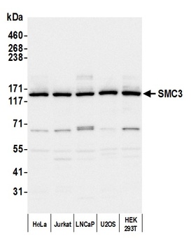 Rabbit SMC3 Antibody