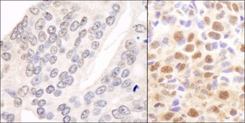 Rabbit CSN2 Antibody