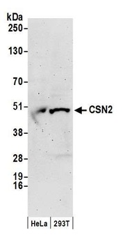 Rabbit CSN2 Antibody