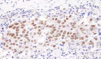 Rabbit GTF2I/TFII-I Antibody