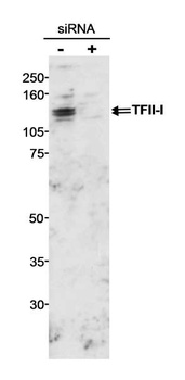 Rabbit GTF2I/TFII-I Antibody