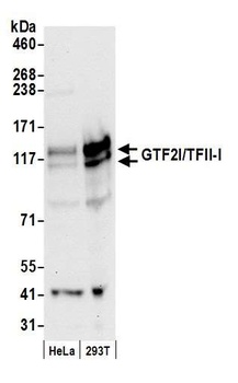 Rabbit GTF2I/TFII-I Antibody