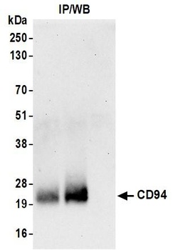 Rabbit anti-CD94 Recombinant Monoclonal Antibody