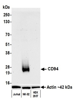 Rabbit anti-CD94 Recombinant Monoclonal Antibody