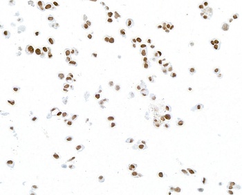 Mouse PAX8 Monoclonal Antibody