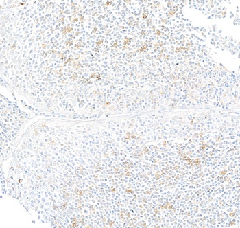 Rabbit anti-IFN-gamma Recombinant Monoclonal Antibody