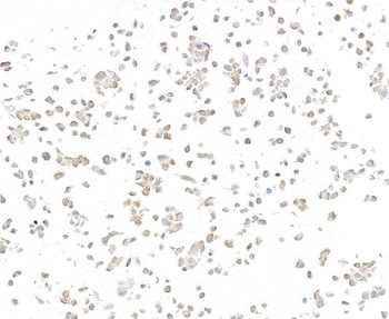 Mouse anti-p16INK4a Recombinant Monoclonal Antibody